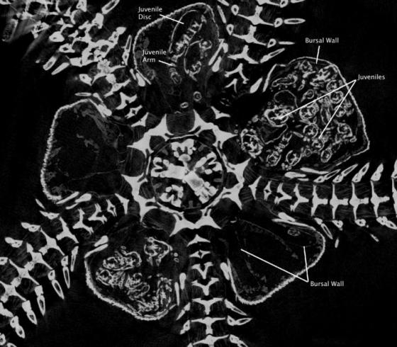 Brooding Brittle Star Babies in 3D